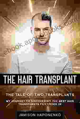 THE HAIR TRANSPLANT: The Tail Of Two Transplants My Journey To Discovering The Best Hair Transplants For Under 2K